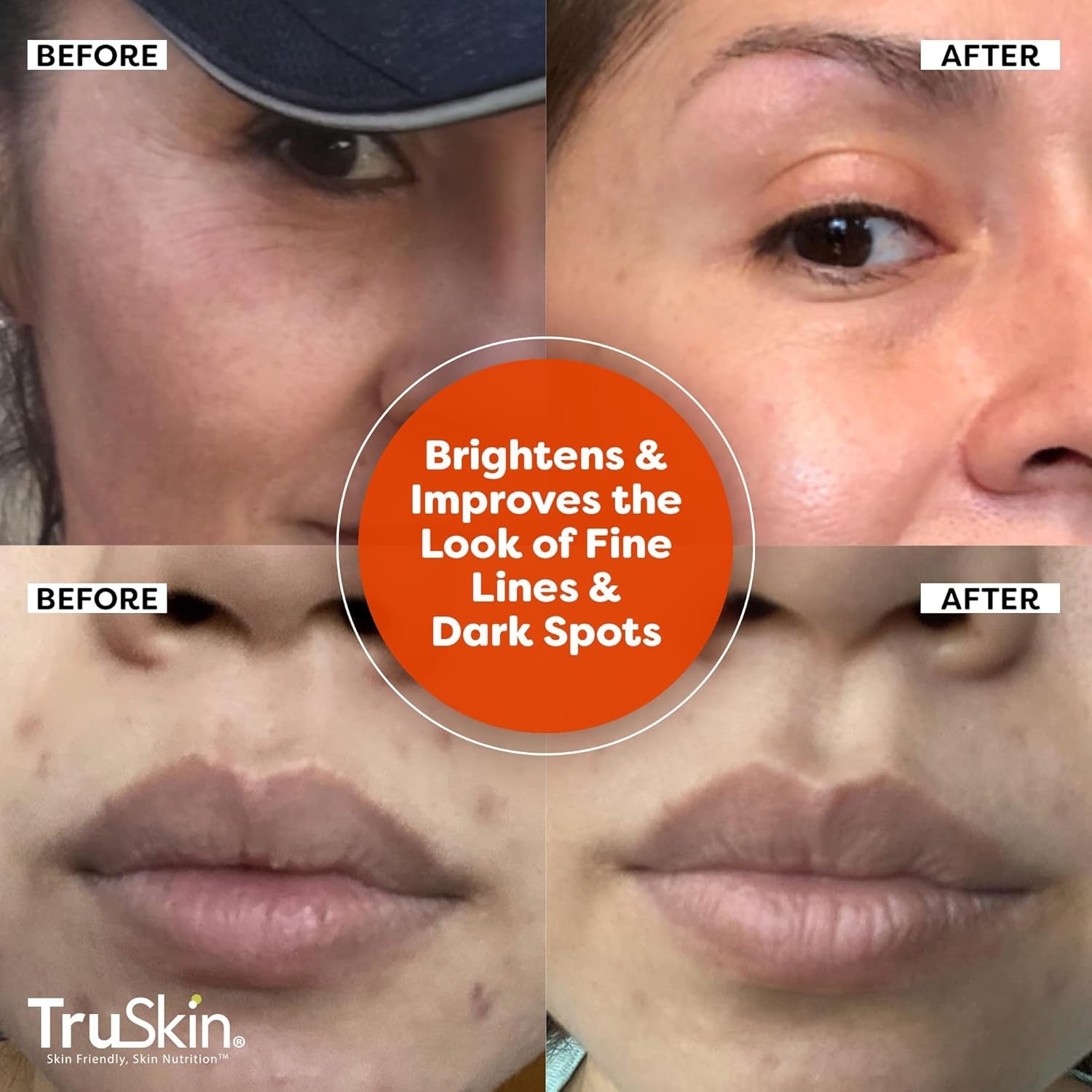 Truskin Vitamin C Serum for Face – anti Aging Formula with Vitamin C, Hyaluronic Acid, Vitamin E – Brightening Serum – Improve Appearance of Dark Spots, Tone, Fine Lines & Wrinkles, 1 Fl Oz