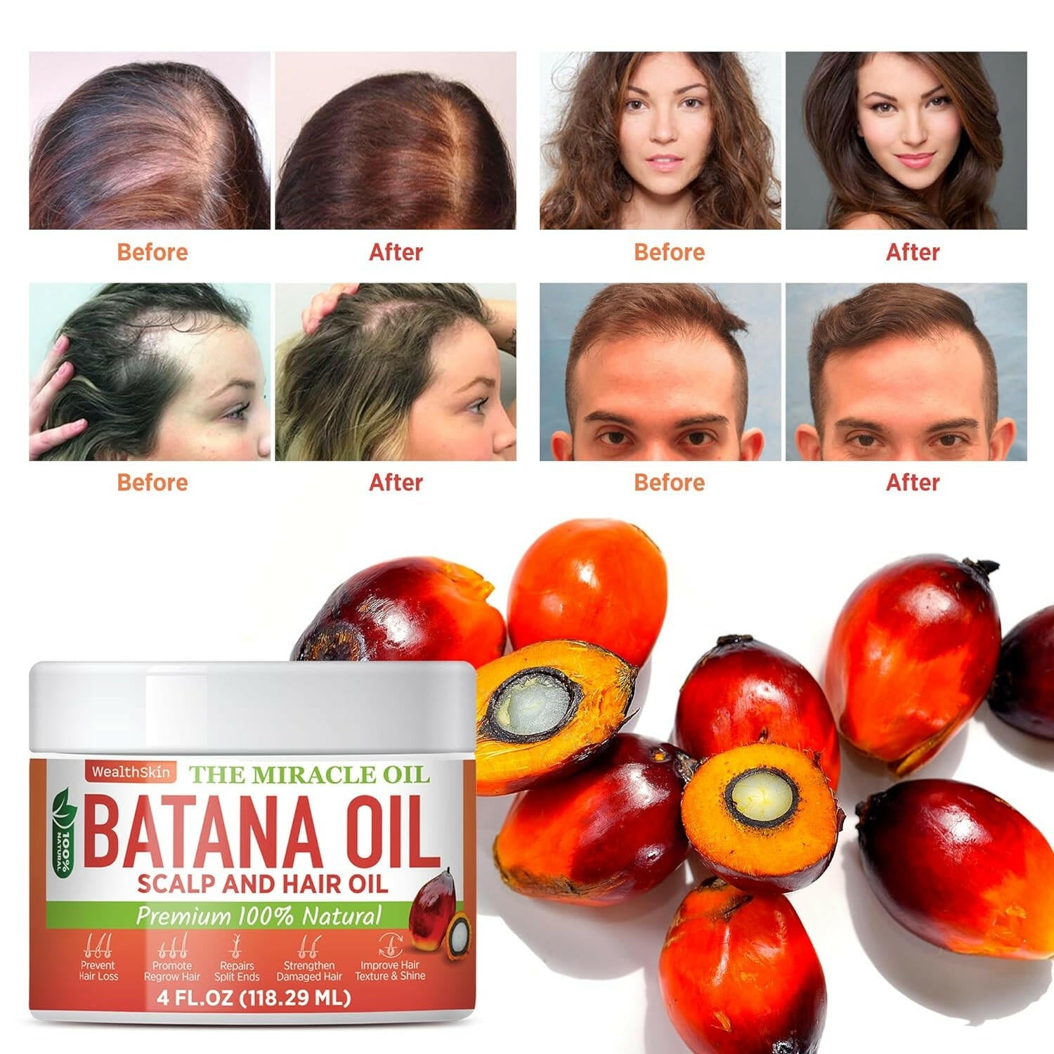 Batana Oil for Hair Growth: 100% Batana Oil from Honduras as Hair Mask, Scalp and Hair Oil. Repairs Damaged Hair &amp; Skin, Reduces Hair Loss 4Oz (4Oz (118Ml)) - Glow Pure