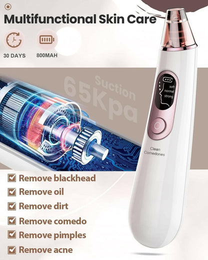 Electric Blackhead Remover Vacuum: Pore Cleaner Kit - Glow Pure