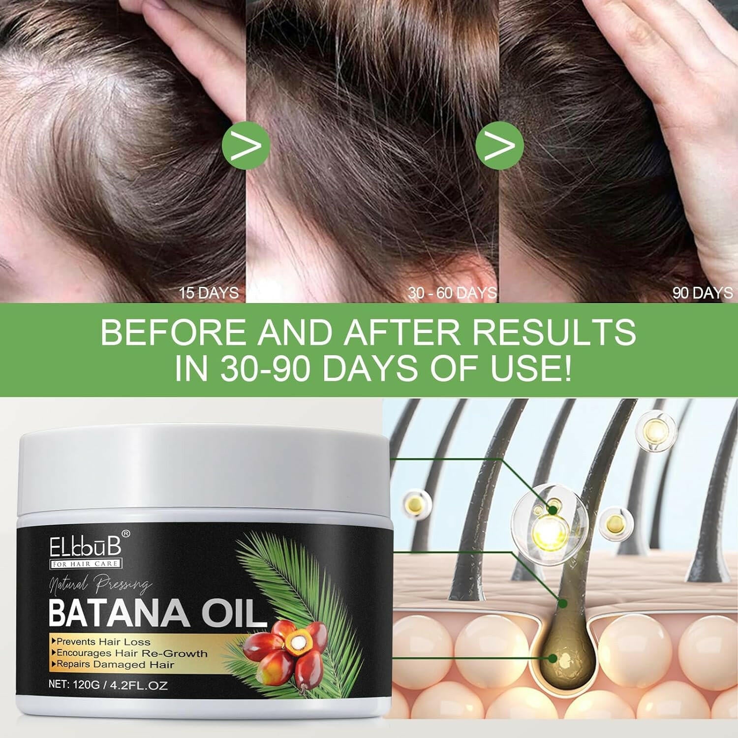 Raw Batana Oil for Hair Growth and Repair - 100% Pure, Unrefined Oil from Honduran Rainforests Prevent Hair Loss and Enhances Hair Thickness in Men &amp; Women - Glow Pure