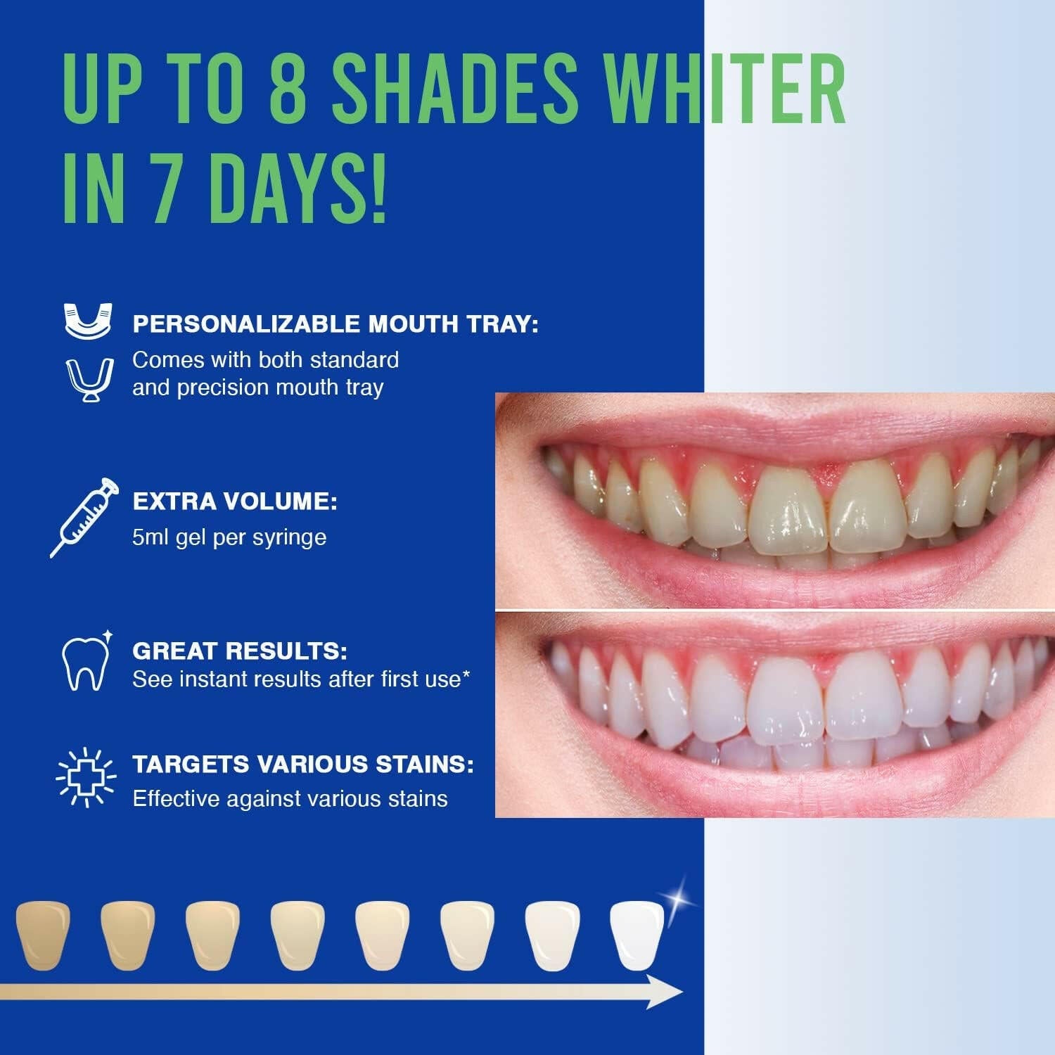 Teeth Whitening Kit - 5X LED Light Tooth Whitener with 35% Carbamide Peroxide, Mouth Trays, Remineralizing Gel and Tray Case - Built - In 10 Minute Timer Restores Your White Smile - Glow Pure